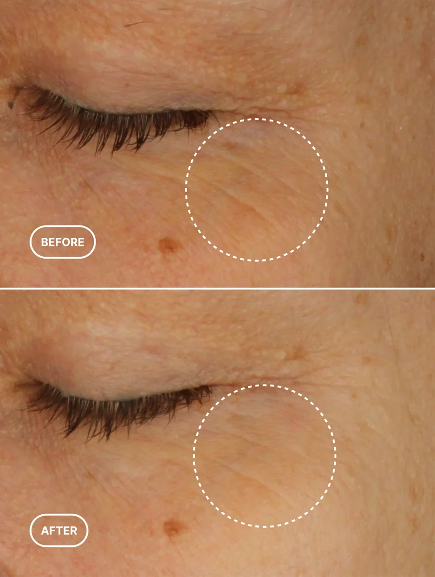 Retinol Alternative Eye Serum-3