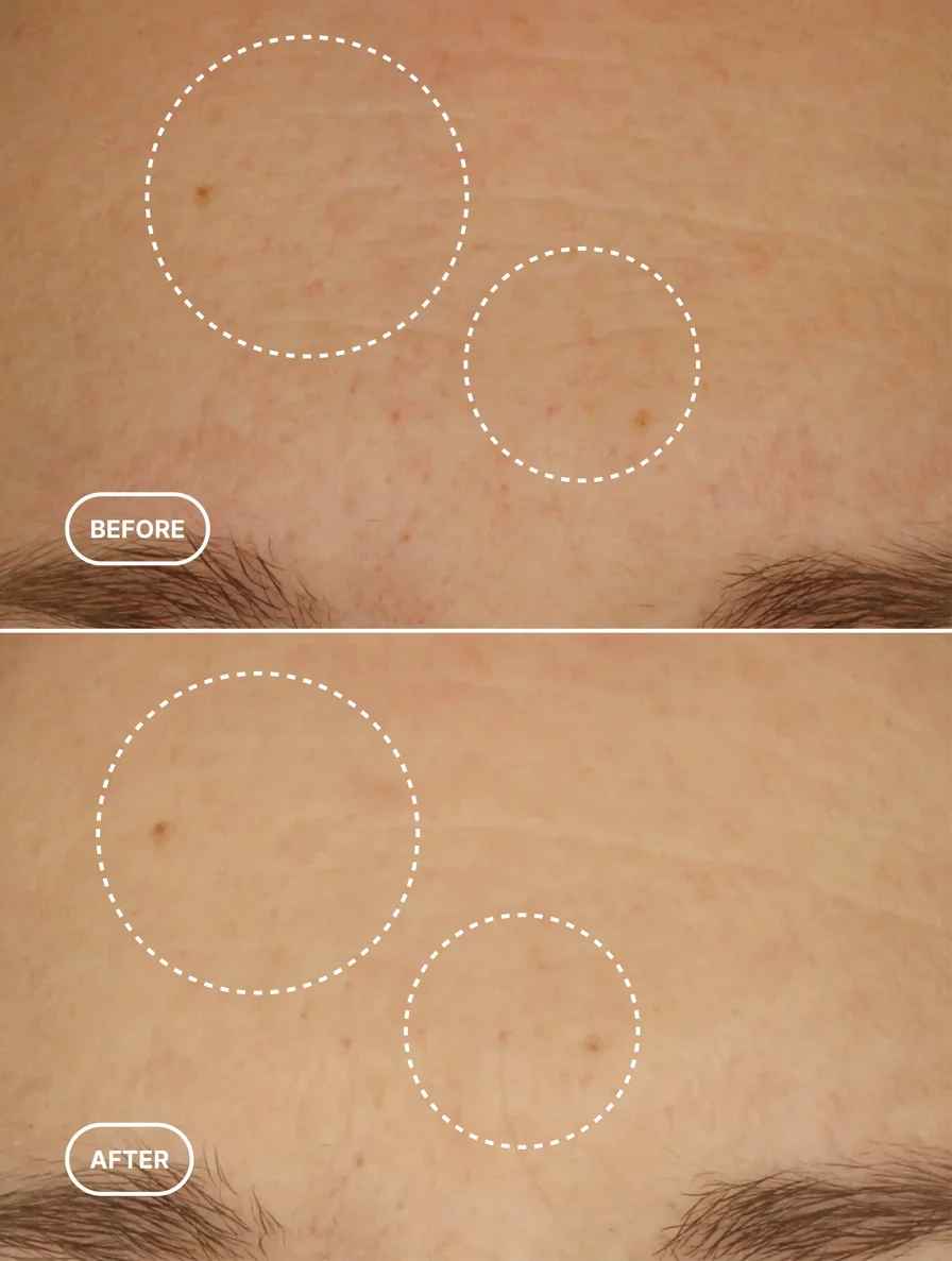 Retinol Alternative Serum-4